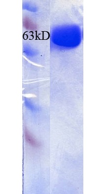 SDS-PAGE - Recombinant human STIP1/STI1 protein (His tag) (AB256160)