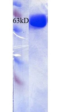 SDS-PAGE - Recombinant human STIP1/STI1 protein (His tag N-Terminus) (AB256160)