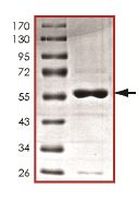 SDS-PAGE - Recombinant Human STK16 protein (AB127160)