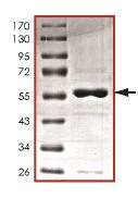 SDS-PAGE - Recombinant Human STK16 protein (AB127160)