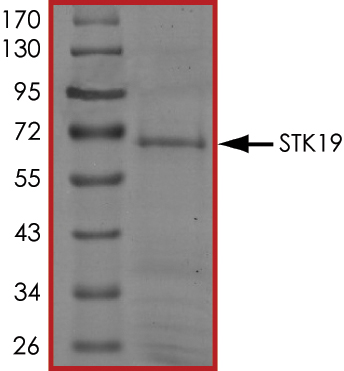 Recombinant human STK19/G11 protein