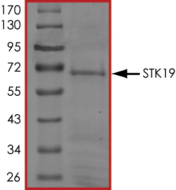 SDS-PAGE - Recombinant human STK19/G11 protein (GST tag N-Terminus) (AB139624)