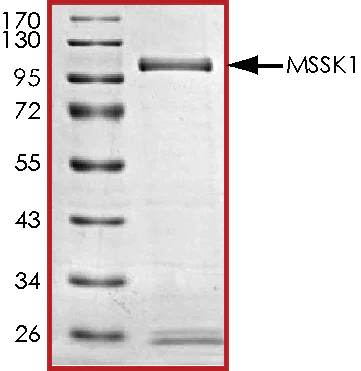SDS-PAGE - Recombinant human STK23 protein (AB84801)