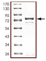 SDS-PAGE - Recombinant human STK25 protein (AB125588)