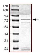 SDS-PAGE - Recombinant Human STK25 protein (AB126929)