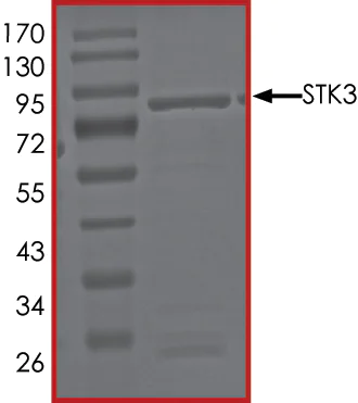 SDS-PAGE - Recombinant human STK3/MST-2 protein (AB60885)