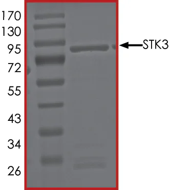 SDS-PAGE - Recombinant human STK3/MST-2 protein (GST tag N-Terminus) (AB60885)
