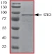 SDS-PAGE - Recombinant human STK3/MST-2 protein (GST tag N-Terminus) (AB60885)