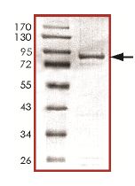 SDS-PAGE - Recombinant Human STK31 protein (AB127094)
