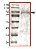 SDS-PAGE - Recombinant human STK36 protein (AB139615), expandable thumbnail