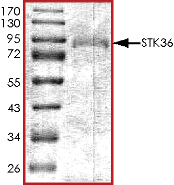 SDS-PAGE - Recombinant human STK36 protein (AB139615)