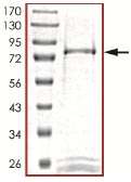 SDS-PAGE - Recombinant Human STK38 protein (AB101505), expandable thumbnail