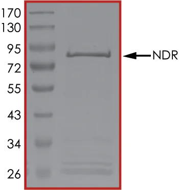 SDS-PAGE - Recombinant human STK38 protein (AB101549)