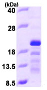 SDS-PAGE - Recombinant Human STMN3 protein (AB97900)