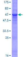 SDS-PAGE - Recombinant Human Stomatin protein (AB132752)