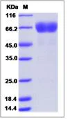 SDS-PAGE - Recombinant Human Stomatin protein (Fc Chimera) (AB276625)