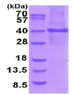 SDS-PAGE - Recombinant Human STOML1 protein (denatured) (AB202205)