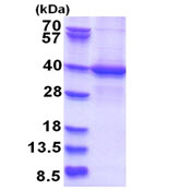 SDS-PAGE - Recombinant Human STRAD protein (denatured) (AB181925), expandable thumbnail