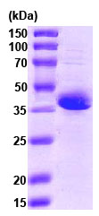 SDS-PAGE - Recombinant Human Stromal interaction molecule 1 protein (AB78681)