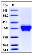 SDS-PAGE - Recombinant Human Stromal interaction molecule 1 protein (His tag) (AB276392)