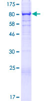 SDS-PAGE - Recombinant Human Sts1 protein (AB153560), expandable thumbnail