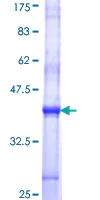 SDS-PAGE - Recombinant Human STT3A protein (AB116946)