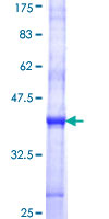 SDS-PAGE - Recombinant Human STT3A protein (GST tag N-Terminus) (AB116946)