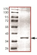 Recombinant Human STUB1/CHIP protein
