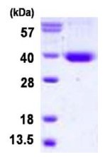 SDS-PAGE - Recombinant Human STX11 protein (denatured) (His tag N-Terminus) (AB126662)