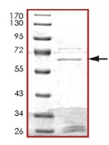 SDS-PAGE - Recombinant Human Styk1/NOK protein (AB125536)