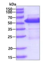 SDS-PAGE - Recombinant Human SUFU protein (AB113584)