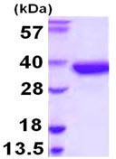 SDS-PAGE - Recombinant Human SULT1A2 protein (His tag N-Terminus) (AB109961)