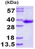 SDS-PAGE - Recombinant Human SULT1B1 protein (His tag N-Terminus) (AB126691)