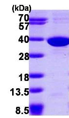 SDS-PAGE - Recombinant Human SULT1C2 protein (AB102759)
