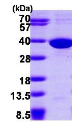 SDS-PAGE - Recombinant Human SULT1C2 protein (His tag N-Terminus) (AB102759)