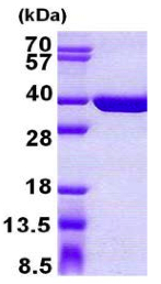 SDS-PAGE - Recombinant Human SULT1C4 protein (AB156984), expandable thumbnail