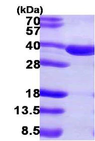 SDS-PAGE - Recombinant Human SULT2A1/ST2 protein (His tag N-Terminus) (AB108128)