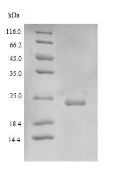 SDS-PAGE - Recombinant Human Superoxide Dismutase 3/EC-SOD protein (AB236186)