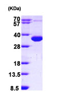 SDS-PAGE - Recombinant Human Superoxide Dismutase 4/CCS protein (His tag N-Terminus) (AB99300)