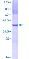 SDS-PAGE - Recombinant Human SUPT16H protein (AB161347)