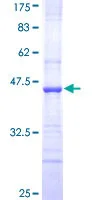 SDS-PAGE - Recombinant Human SUR1 protein (GST tag N-Terminus) (AB152717)