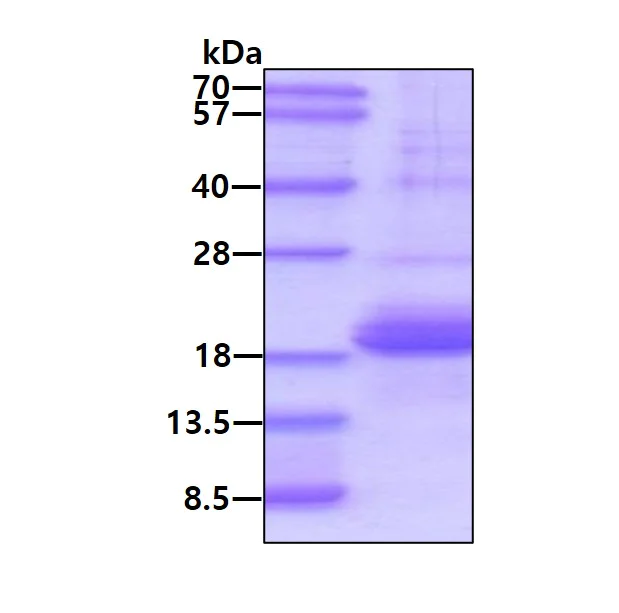 SDS-PAGE - Recombinant Human Surfactant protein D/SP-D (denatured) (His tag N-Terminus) (AB181961)