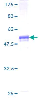 SDS-PAGE - Recombinant Human SVCT1 protein (AB160742)