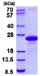 SDS-PAGE - Recombinant Human SYBL1/VAMP-7 protein (AB131706), expandable thumbnail
