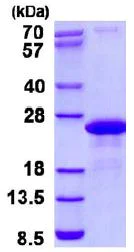 SDS-PAGE - Recombinant Human SYBL1/VAMP-7 protein (AB131706)