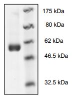 Recombinant human Syk protein
