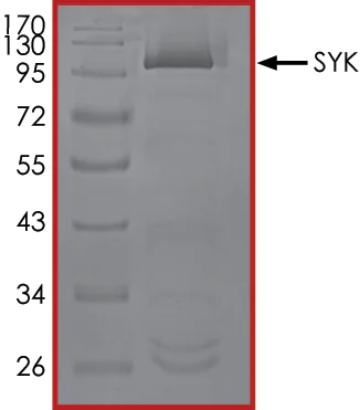 SDS-PAGE - Recombinant human Syk protein (AB60886)
