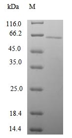 SDS-PAGE - Recombinant Human SYN4 protein (Tagged) (AB239577)