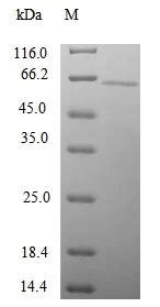 SDS-PAGE - Recombinant Human SYN4 protein (Tagged) (AB239577)