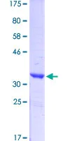 Western blot - Recombinant Human Synapsin I protein (AB152720)